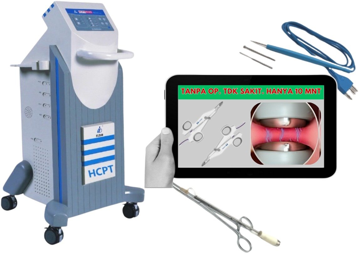 Teknologi untuk mengobati wasir